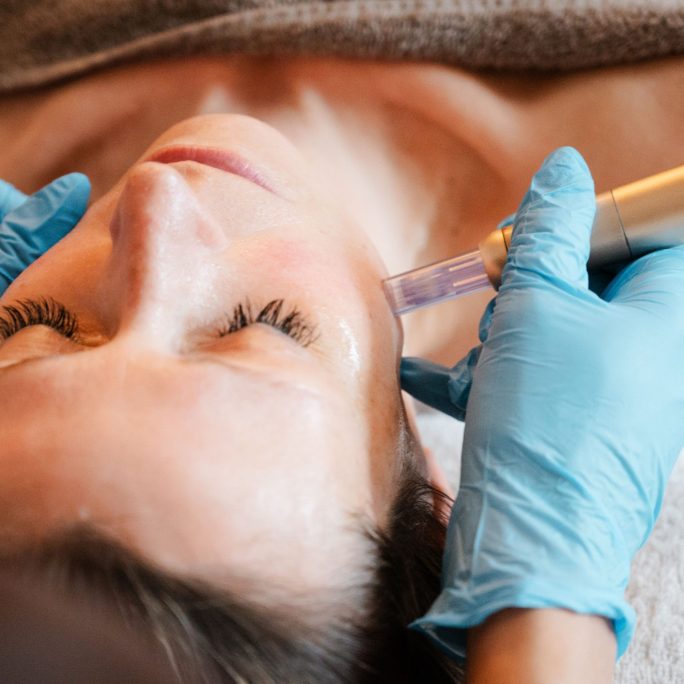 Microneedling voor een stralende huid – Beautique Beauty & Skin Clinic Microneedling behandeling bij Beautique Beauty & Skin Clinic voor huidverbetering en verjonging in Ophasselt, Ninove, Geraardsbergen en omgeving.