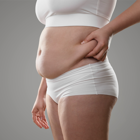 overtollig vet hardnekkig buikvet heupvet armen met vet